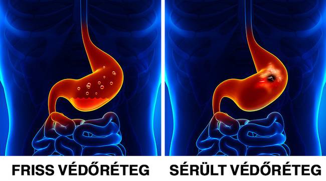 Gyomor védőréteg