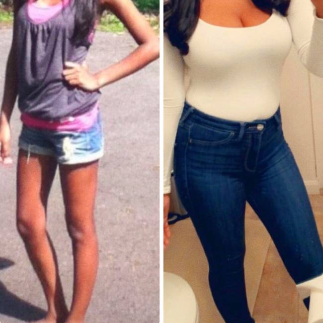 „Anorexiás voltam. Az eredményem + 14 kg."