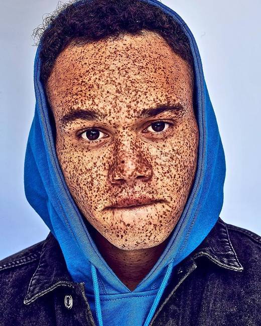 Hamad Jaman - a világ talán legszeplősebb férfimodellje.