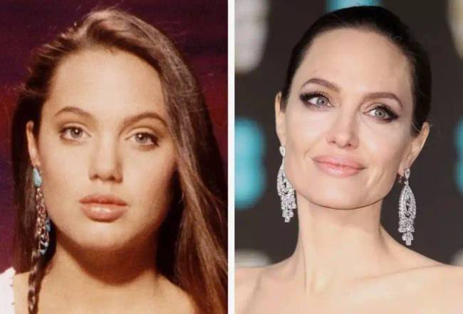 7 hollywoodi sztár, akiknek a külsejét plasztikai műtétek változtatták meg