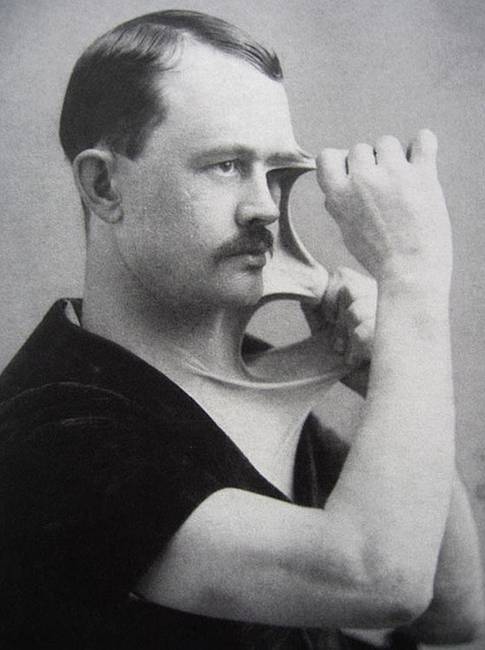 Felix Wehrle, a hihetetlenül nyúlós bőréről elhíresült férfi, az 1900-as évek elején.