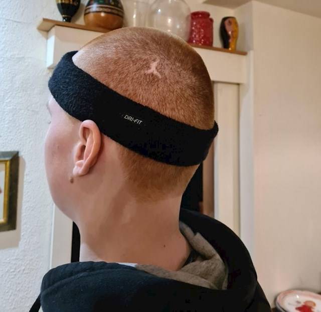 „A bátyám fején lévő heg úgy néz ki, mint egy Air Jordan logó."
