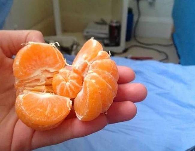 Egy mandarin, aminek a belsejében egy másik, kisebb mandarin lapult.