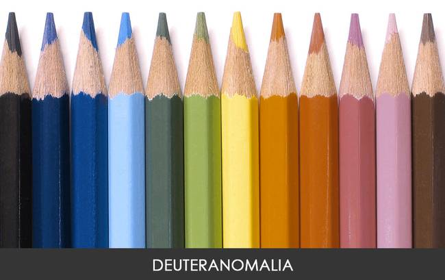 Deuteranopia