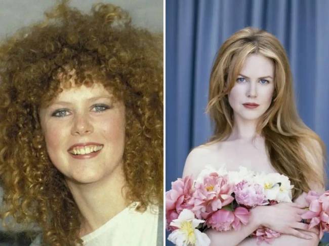 7 hollywoodi sztár, akiknek a külsejét plasztikai műtétek változtatták meg