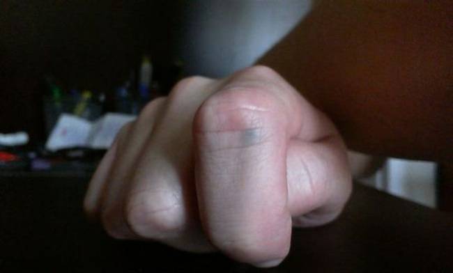 „13 évvel ezelőtt egy ceruzahegyből származó grafitdarab ragadt az ujjamban."