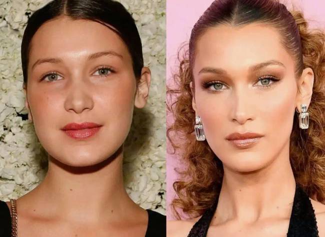7 hollywoodi sztár, akiknek a külsejét plasztikai műtétek változtatták meg