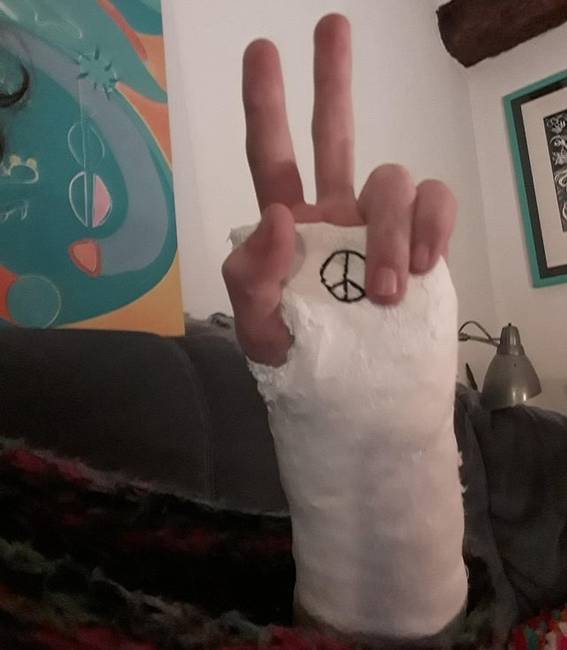 „3 nappal az új-zélandi utazásom és az új munkahelyemen kezdés előtt eltörtem a csuklóm."