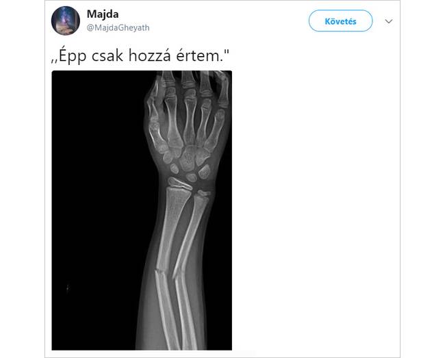 Mindig ez van.