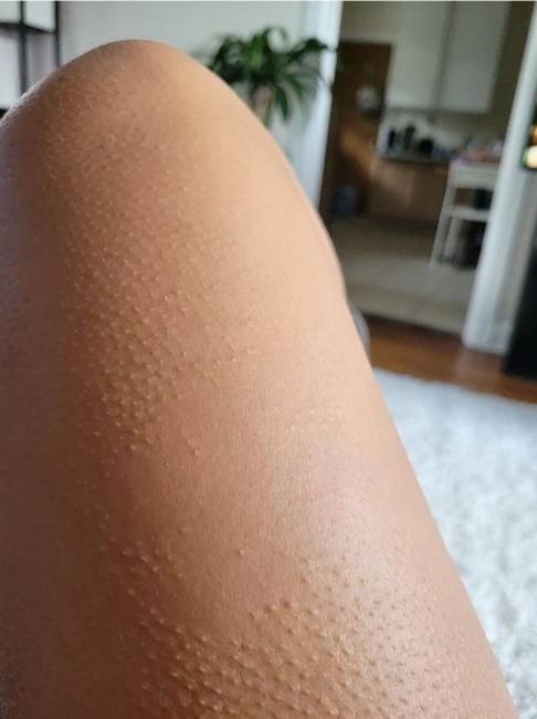 „Van egy hely a lábamon, ahol soha nem vagyok libabőrös."
