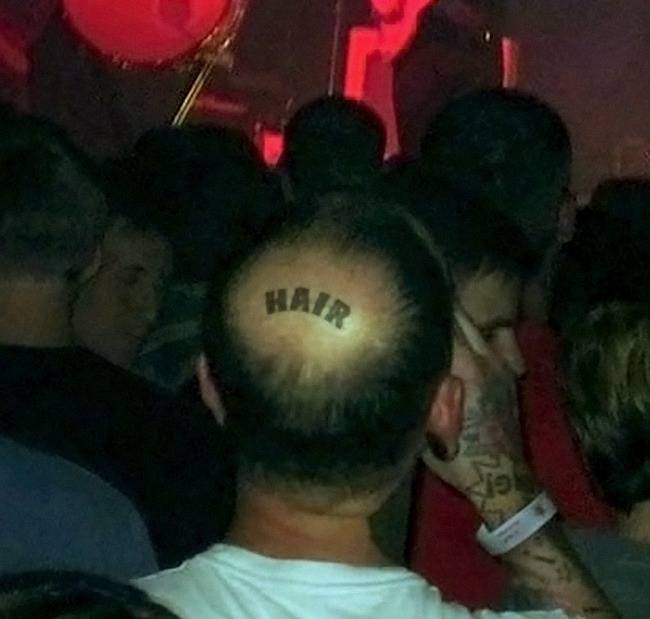 Tény és való, hogy egy ilyen tetkó még mindig olcsóbb, mint egy hajbeültetés.