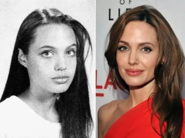 7 hollywoodi sztár, akiknek a külsejét plasztikai műtétek változtatták meg