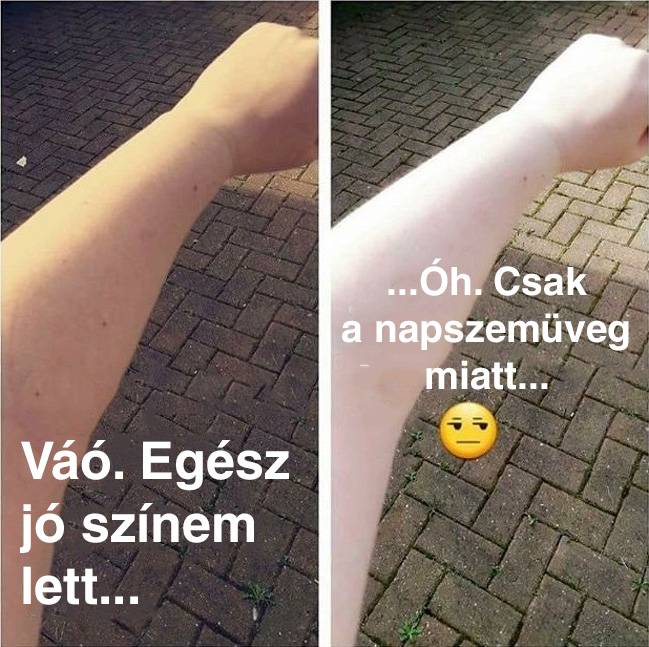 Minden egyes nyári napozáskor.