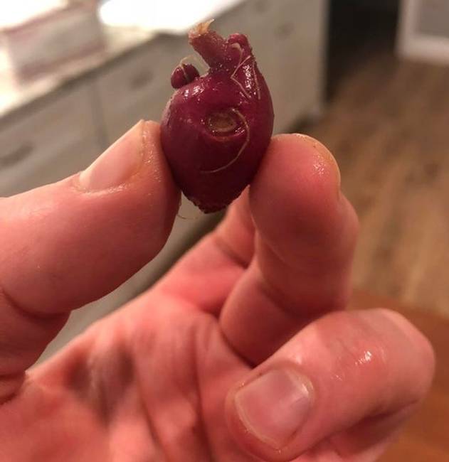 „Ez a kis piros burgonya olyan, mint egy anatómiailag pontos szív."