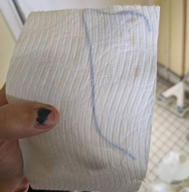 „Találtam egy gumit a WC-papírban."