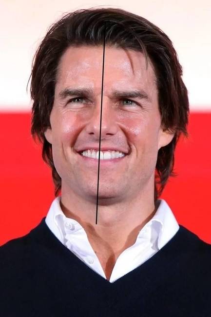 Tom Cruise fölső fogsora el van tolódva, aminek köszönhetően az arca teljesen aszimmetrikus.