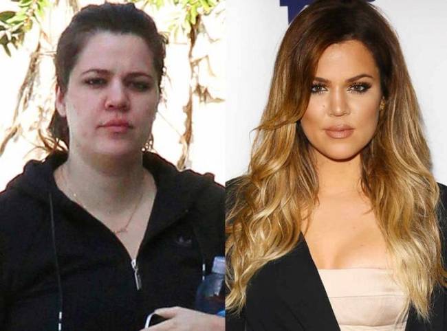 Khloe Kardashian