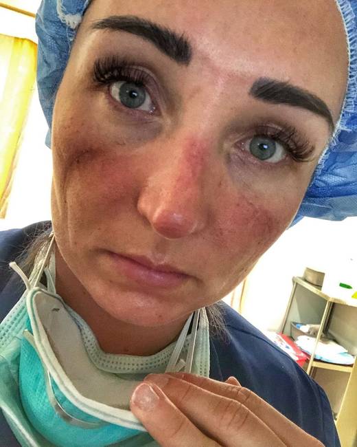 „Számomra már normálissá vált, hogy ez az arc néz rám, amikor a tükörbe nézek."