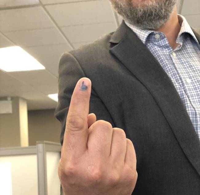 A mutatóujj zúzódása remekül mutatja, hogy mit csinál éppen a tulajdonosa.