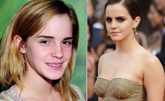 Emma Watson