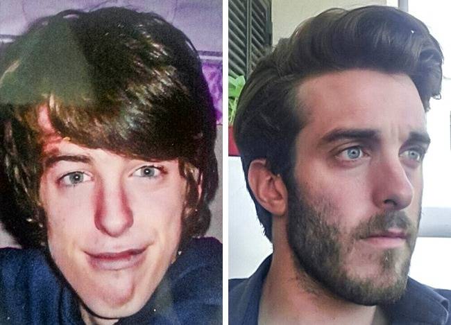 14 és 24 évesen.