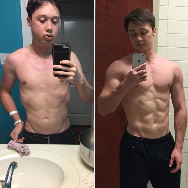 „Állkapocs műtét előtt és után. Közben 65 kg-ról 82 kg-ra "híztam" a kemény edzéssel."