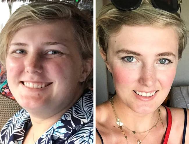 „18 kg-ot fogytam 7 hónap alatt. Alig tudom elhinni, hogy ilyen az új arcom!"