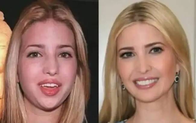 7 hollywoodi sztár, akiknek a külsejét plasztikai műtétek változtatták meg