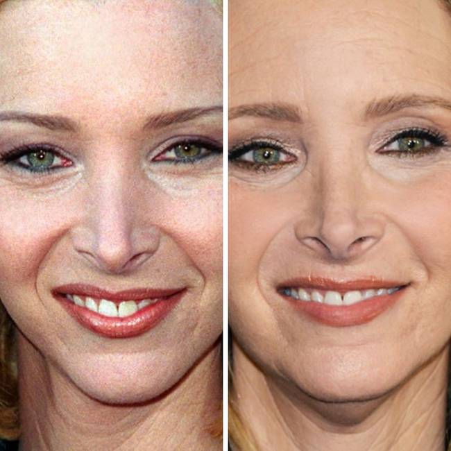 Lisa Kudrow