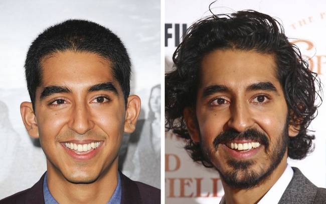 Dev Patel