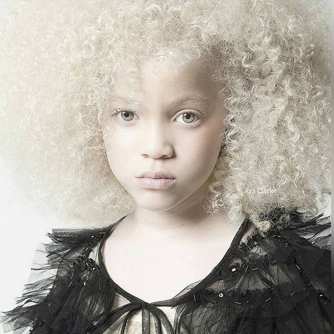 Ava Clarke - afroamerikai albínó modell.
