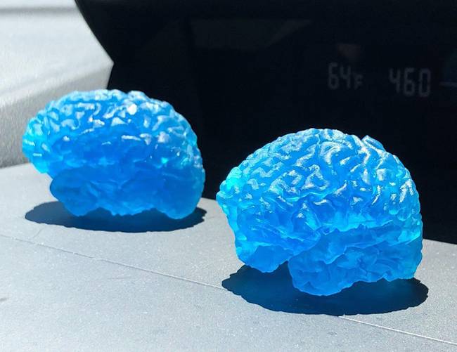 Ez történik, ha az emberi agyról készült MRI képet egy 3D nyomtató segítségével kinyomtatjuk.