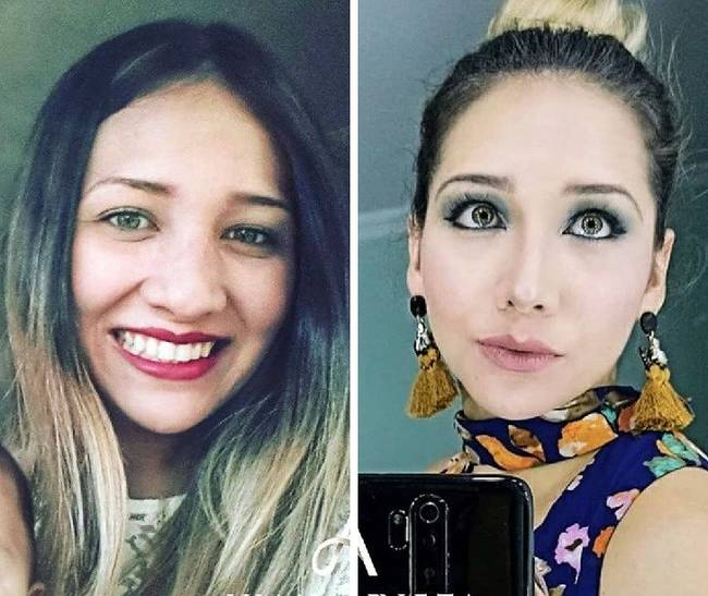 20 nő, aki megcsináltatta az orrát, és most nem hiszed el, hogy ugyanaz a személy van a fotón