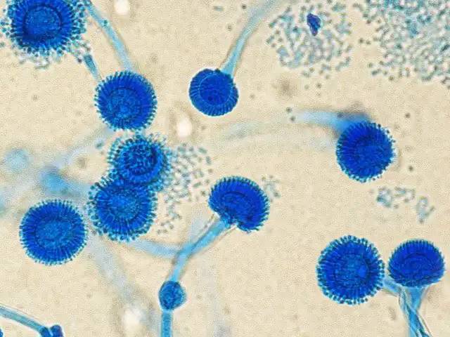 Az Aspergillus fumigatus egy széles körben elterjedt penészgomba, amely kulcsszerepet játszik a szerves anyagok lebontásában a természetben, ám komoly veszélyt jelent az orvostudomány számára. Mikroszkopikus spórái folyamatosan jelen vannak a levegőben, és bár egy egészséges immunrendszer könnyen megbirkózik velük, a legyengült immunrendszerű embereknél a gomba súlyos tüdőkárosodást – aspergillosist – okozhat. Mivel képes túlélni a magas hőmérsékletet és gyorsan alkalmazkodik az agresszív környezethez, ez a faj a kórházi gombás fertőzések fő okozójává vált, ami különös figyelmet követel a fertőtlenítés és a szellőztetőrendszerek minősége terén.