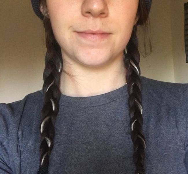 „Egy vitiligo folt van a hajamban a fejem hátsó részén, pontosan középen, szóval amikor befonom a hajam, így néz ki."