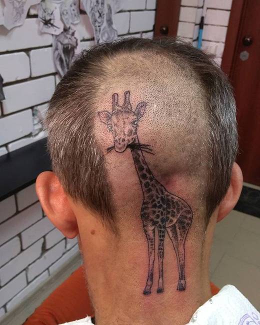 Ilyen humorérzékkel az alopecia areata (foltos hajhullás) sem jelent problémát.