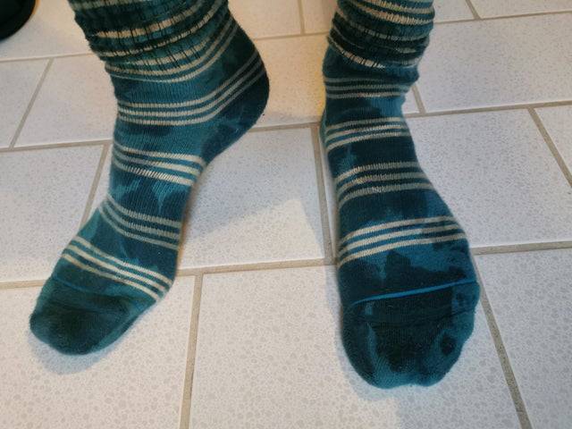 „A zoknim dizájnja miatt olyan, mintha összevizeztem volna valahol."