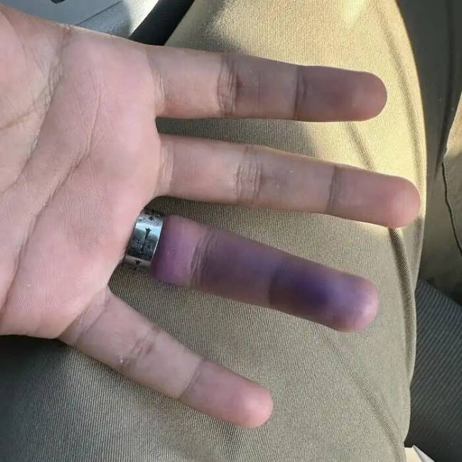 Amikor minden rosszul alakul: 17 vicces példa a nagyon rossz napokra