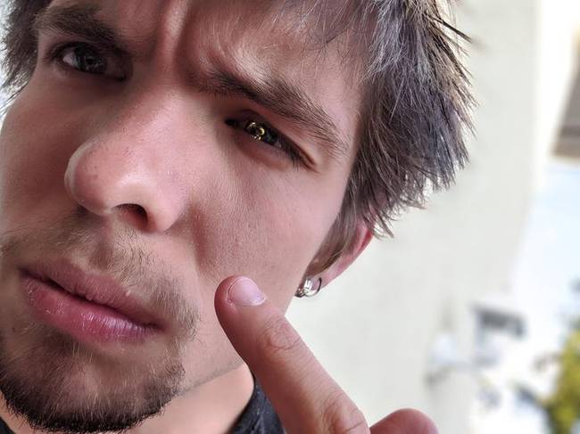 Az aranyszem hatást valójában egy darázs okozta a szeme előtt.
