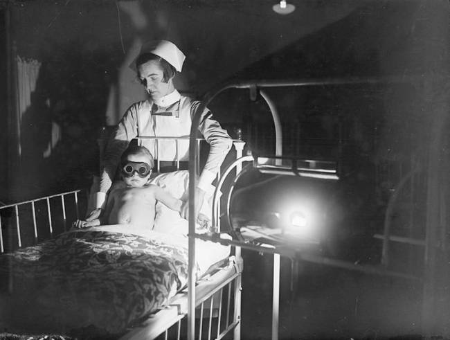 Nap-terápiával kezelt gyermek, 1928-ban.