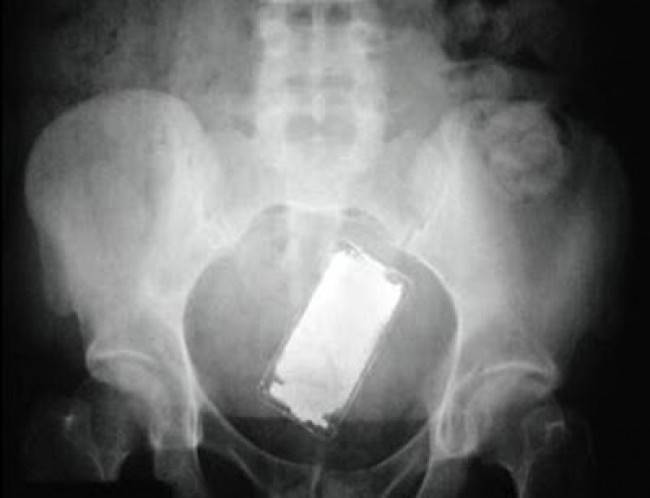 iPhone.