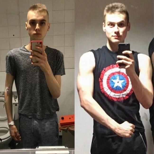 „Legyőztem az anorexiát és a saját szuperhősömmé váltam."