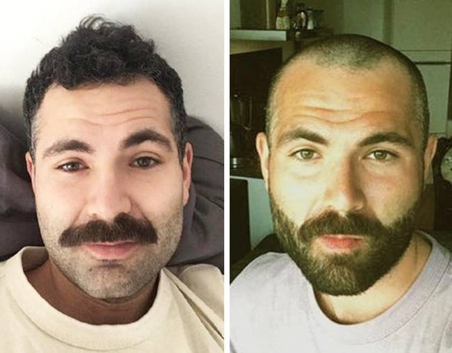 „Miután éveken át igyekeztünk mindent megtenni a fodrászommal azért, hogy elrejtsük a kopasz területeket, végül úgy döntöttem, hogy mindet levágatom. Imádom!"