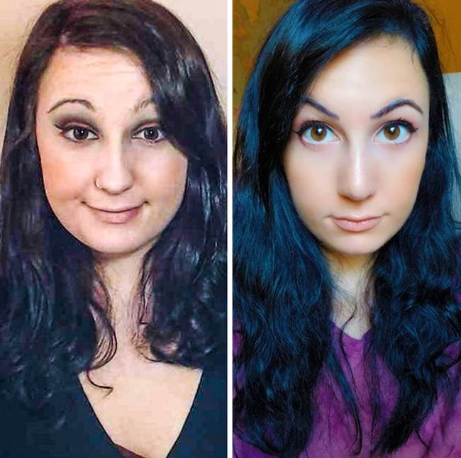 „11 hónapnyi változás: 27 kilót fogytam, kijavíttattam az orromat és megcsináltattam a szemöldökömet.”