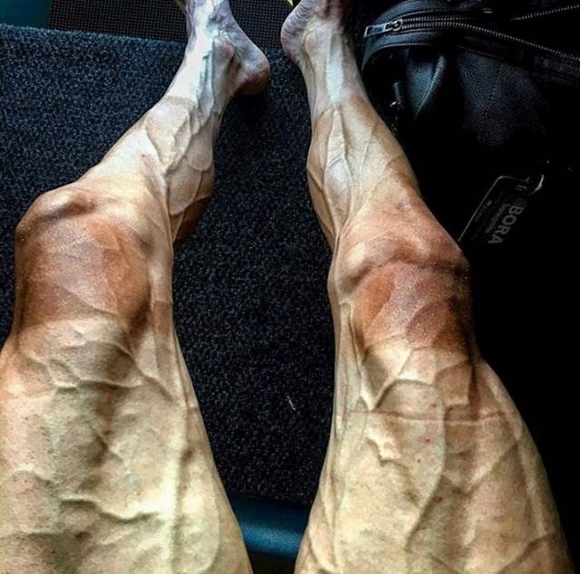Ezt a fotót a lengyel kerékpáros, Pawel Poljanski tette közzé az Instagramon. Így nézett ki a lába a Tour de France verseny leghosszabb, 165 km hosszú szakasza után.