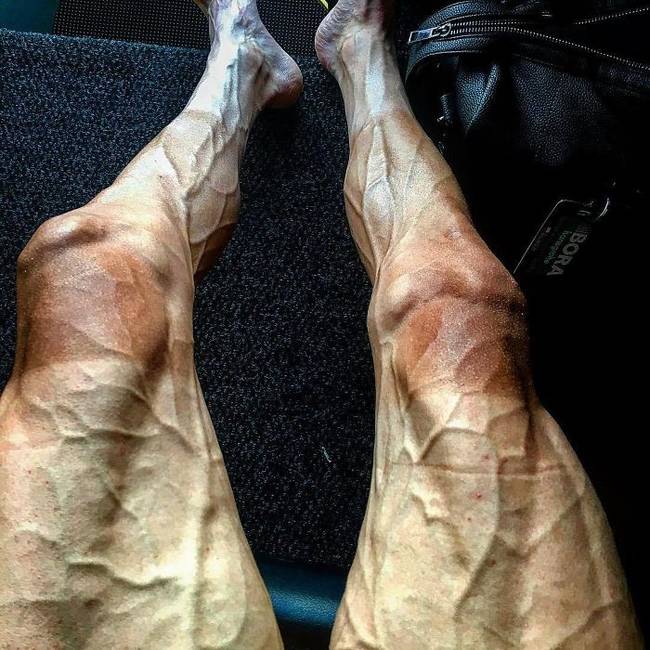 Így néznek ki egy kerékpáros lábai a Tour De France verseny után.