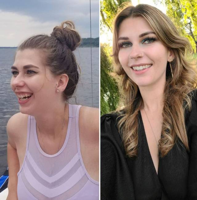 16 előtte/utána fotó, ami csak pozitív változásokat mutat