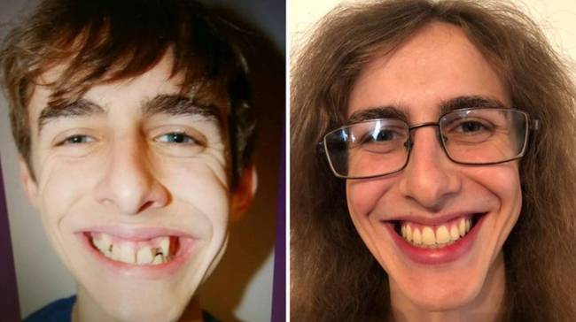 16 előtte/utána fotó, ami csak pozitív változásokat mutat
