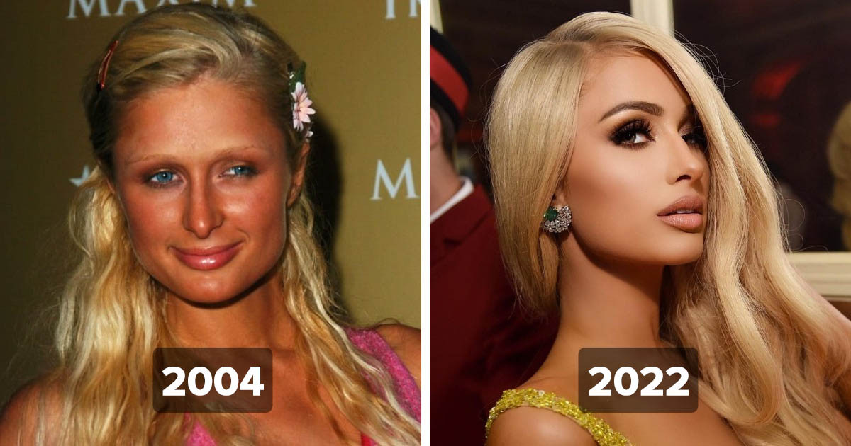 13 híresség, aki ma teljesen másképp néz ki, mint a 2000-es években