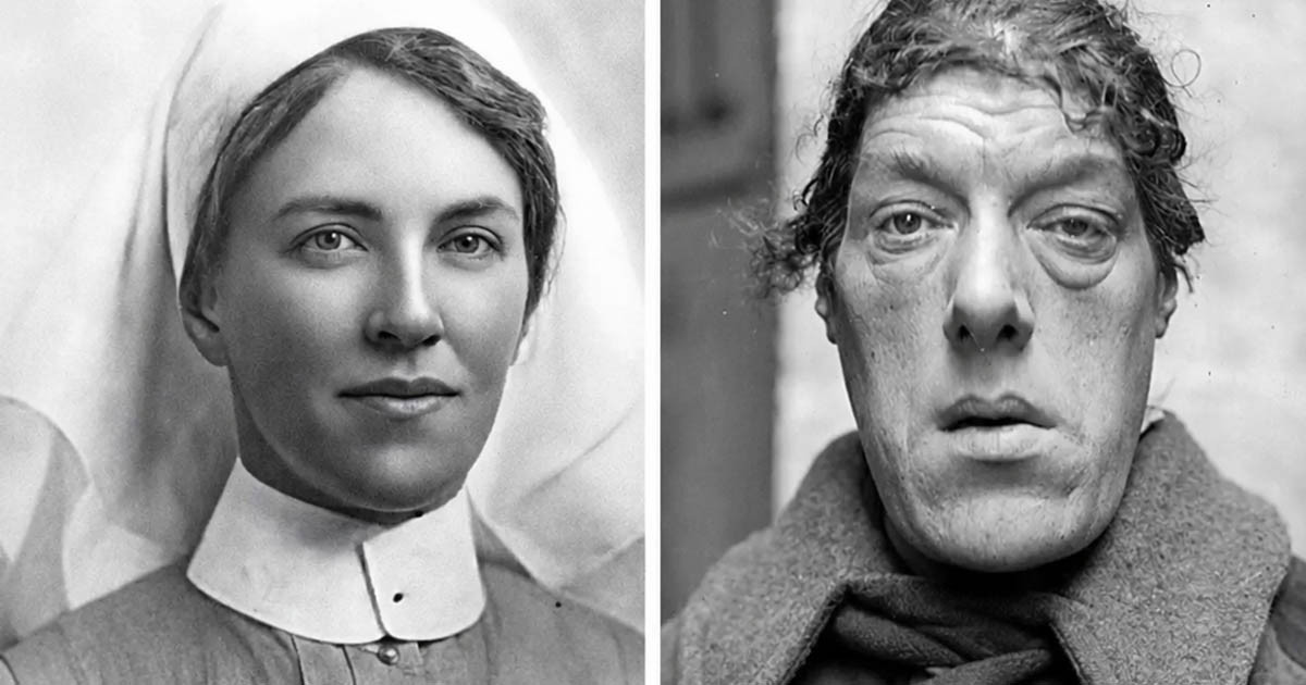 Szépségből szörnyeteg: A „világ legrondább nőjének” története, Mary Ann Webster